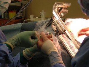 Brain_biopsy_under_stereotaxy