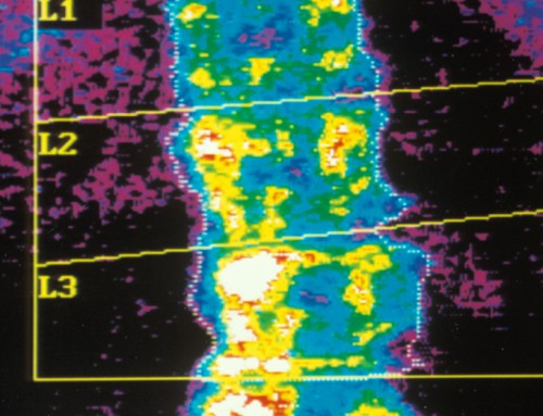 L’Inserm parle de l’imagerie médicale